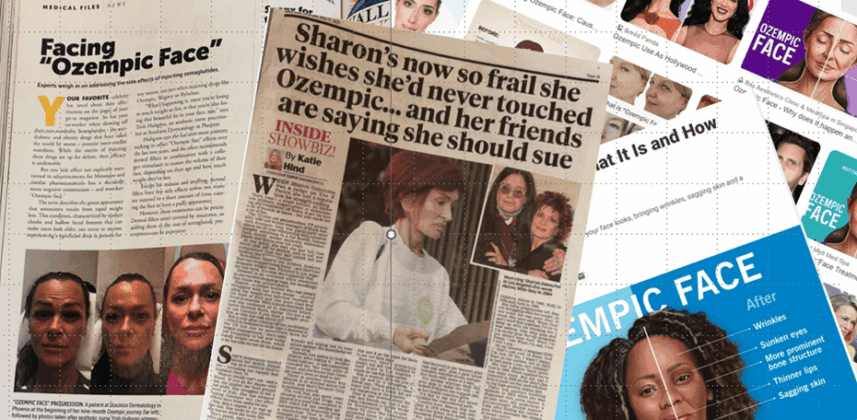 What is Ozempic face — and can you prevent it?