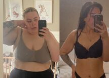 Wear compression socks for the rest of my life?!? Your jab life unfiltered