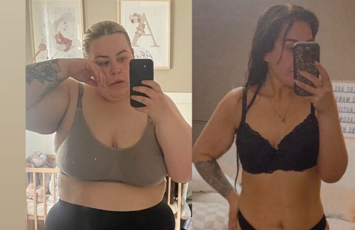 Wear compression socks for the rest of my life?!? Your jab life unfiltered